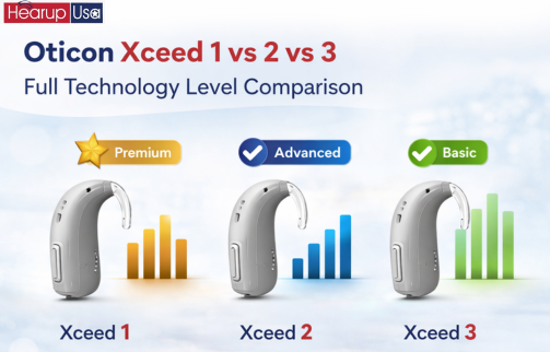 Oticon Xceed 1 vs Oticon Xceed 2 vs Oticon Xceed 3: Full Technology Level Comparison
