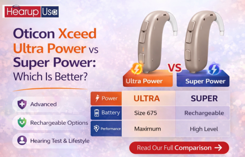 Oticon Xceed Ultra Power vs Oticon Xceed Super Power: Which Is Better?
